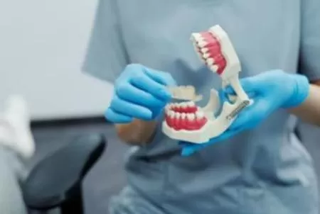 Какие есть зубные импланты?